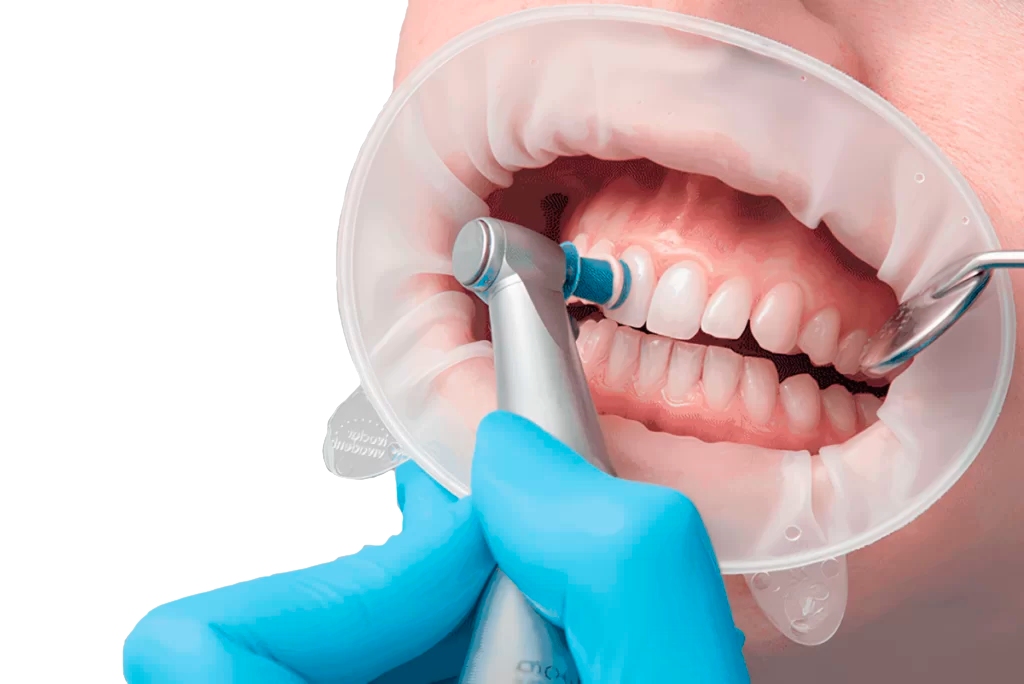 Профессиональная гигиена