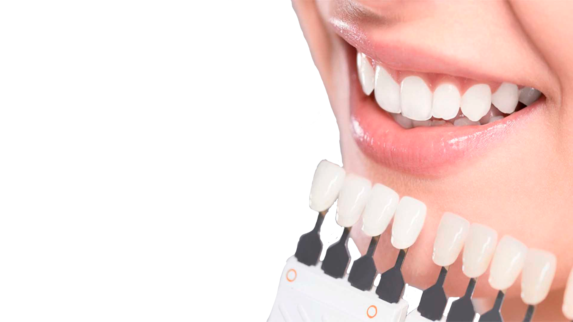 Отбеливание зубов